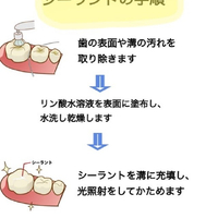 画像287
