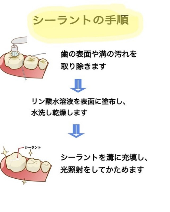 画像287