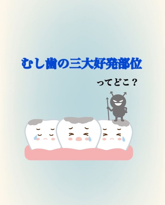 画像321