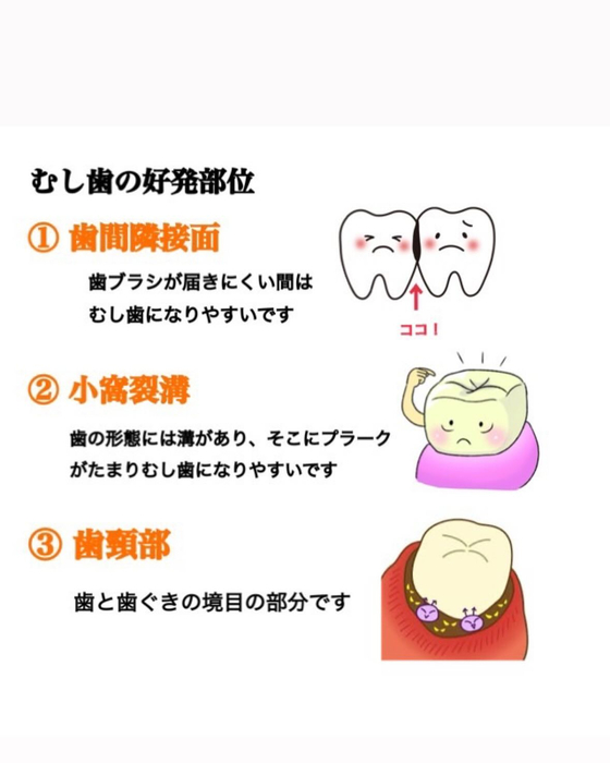 画像322