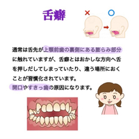 画像329