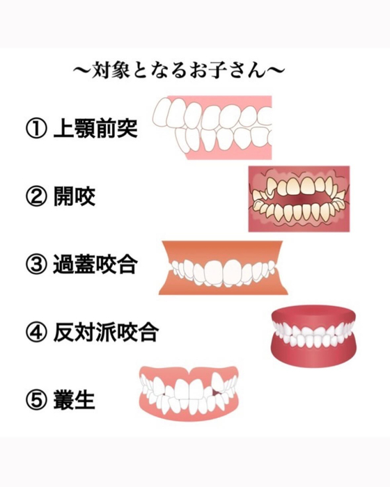 画像381