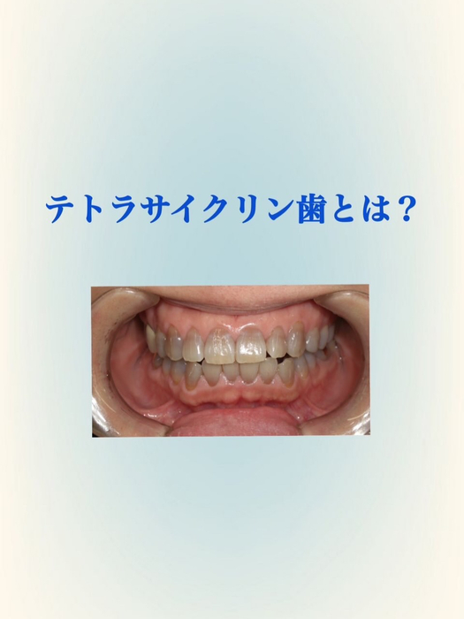 画像580